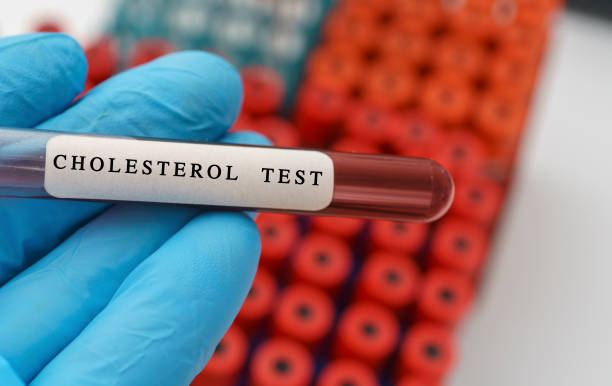cholesterol blood test, conceptual image - コレステロール ストックフォトと画像