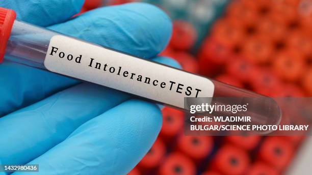 food intolerance blood test, conceptual image - allergia foto e immagini stock