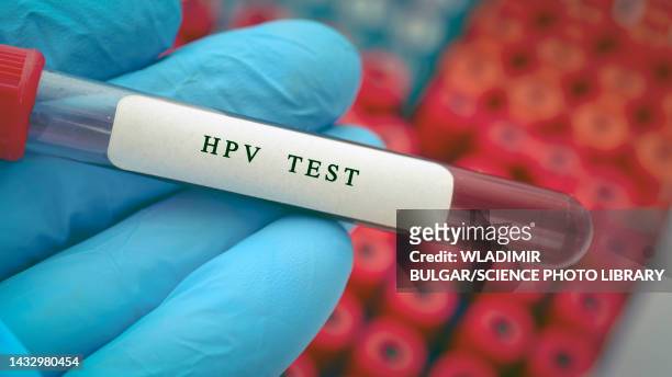 hpv blood test, conceptual image - virus del papilloma umano foto e immagini stock