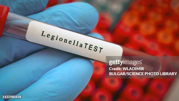 legionella blood test, conceptual image - legionella stock-fotos und bilder