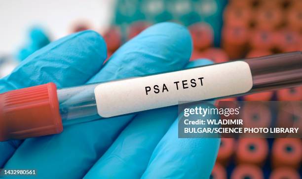 prostate-specific antigen test, conceptual image - psa stock pictures, royalty-free photos & images