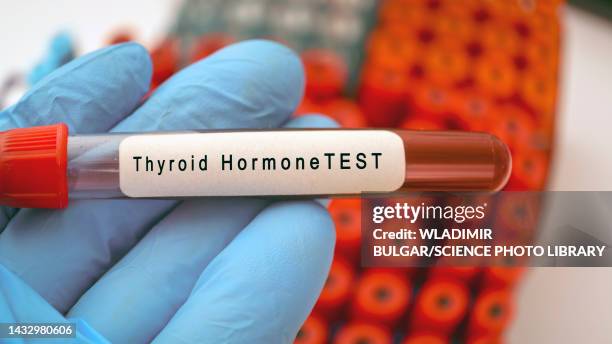 thyroid blood test, conceptual image - tiroide foto e immagini stock