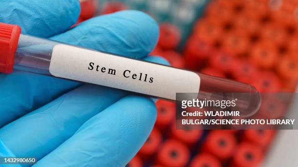 stem cells sample, conceptual image - bone marrow transplant foto e immagini stock