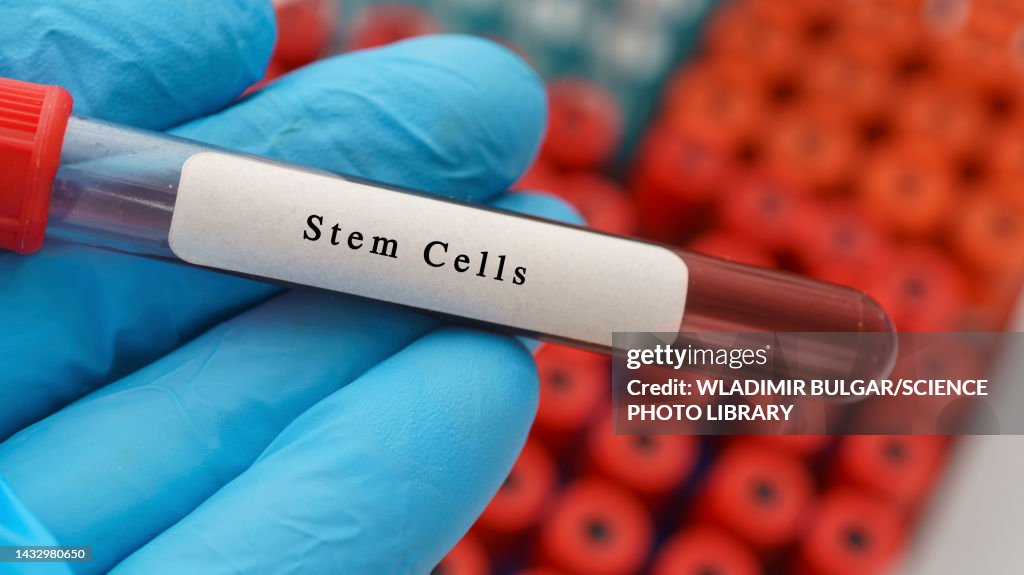 Stem Sample Stem Cells Sample Conceptual Image High-Res Stock Photo - Getty Images