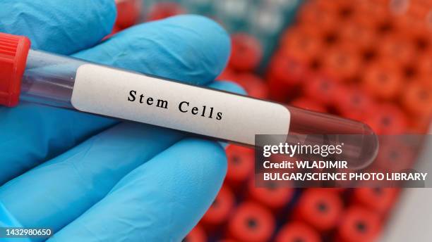 stem cells sample, conceptual image - stem cell therapy stock pictures, royalty-free photos & images