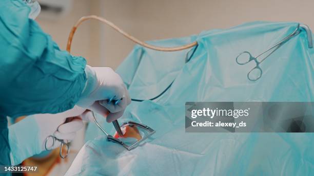 el médico realiza una cirugía oral: el médico realiza una cirugía oral con la ayuda de pinzas y tubo quirúrgico - tubo de succión fotografías e imágenes de stock