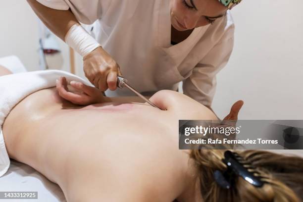 physiotherapist massaging patient's shoulder - scraping stock pictures, royalty-free photos & images