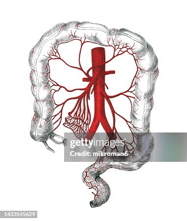 Inferior Mesenteric Artery