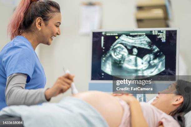 pregnant woman at an ultrasound appointment - ecografia imagens e fotografias de stock