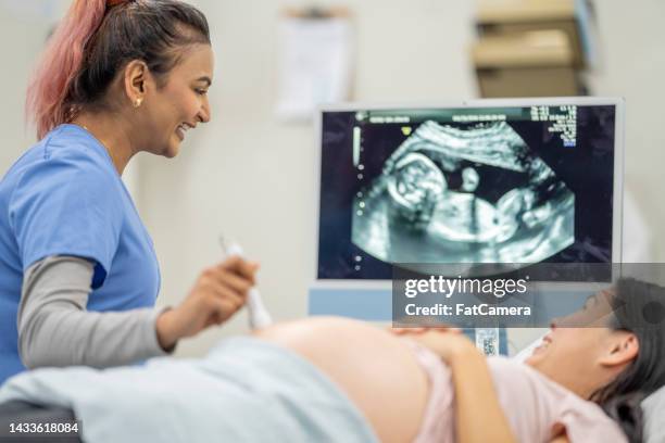 pregnant woman at an ultrasound appointment - ultraljud bildbanksfoton och bilder