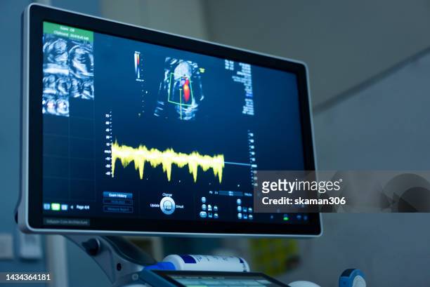 ultrasound sonogram of fetus 22 week pregnant - 20 week foetus stock pictures, royalty-free photos & images