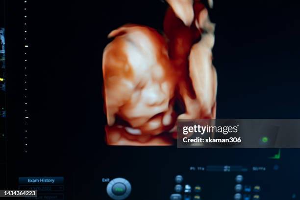 doctor used an ultrasound  3d sonogram  monitor for  the fetus 22 weeks young adult patient pregnant - 20 week foetus stock pictures, royalty-free photos & images