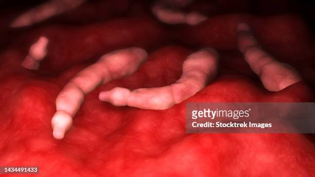 conceptual biomedical illustration of echinococcus parasites inside the liver - taenia saginata stock illustrations