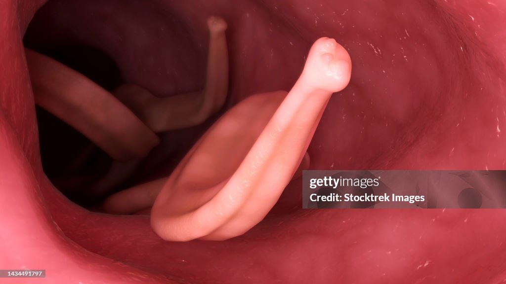 Conceptual biomedical illustration of Ascaris lumbricoides in the human intestines