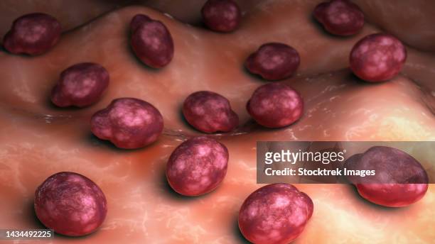 conceptual biomedical illustration of malassezia furfur fungus on the skin - arenavirus stock illustrations