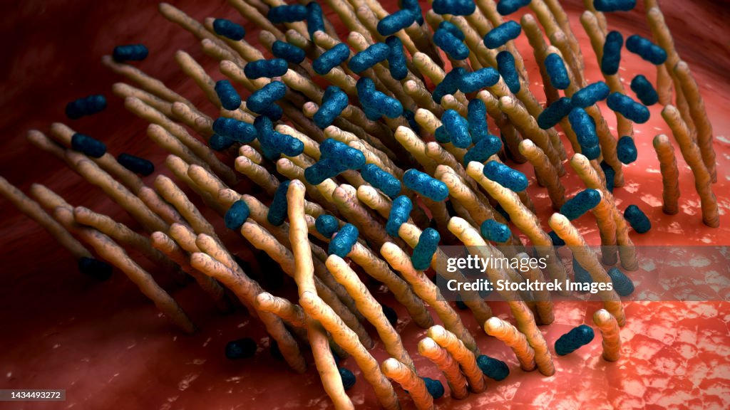 Conceptual biomedical illustration of the bacterial disease pertussis, also known as whooping cough