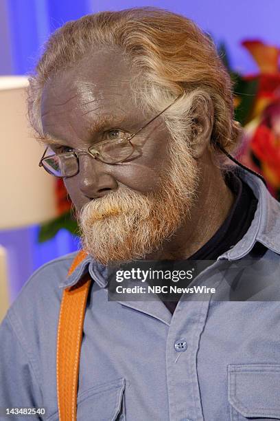 Paul Karason -- Air Date 2/6/08 -- Pictured: Paul Karason talks with NBC News' "Today" about turning permanently blue after using colloidal silver on...