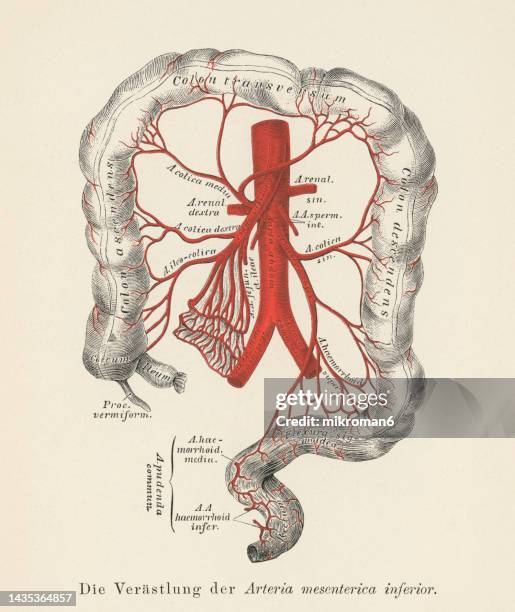 56 Mesenteric Artery Stock Photos, High-Res Pictures, and Images ...