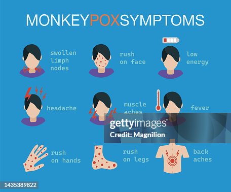 Monkeypox Symptoms Monkeypox Symptoms