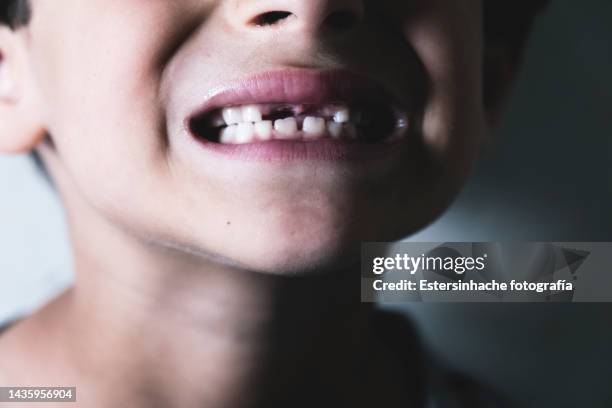 portrait of a boy who has lost a tooth, who happily shows his mouth - tooth fairy stockfoto's en -beelden