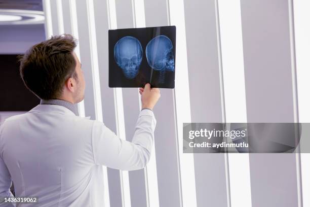 male doctor examining an x-ray image - skull xray no brain stock pictures, royalty-free photos & images