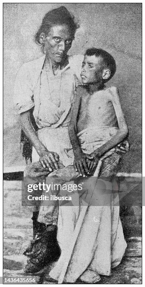 Antique image: Cuban famine people malnutrition Antique image: Cuban famine people malnutrition