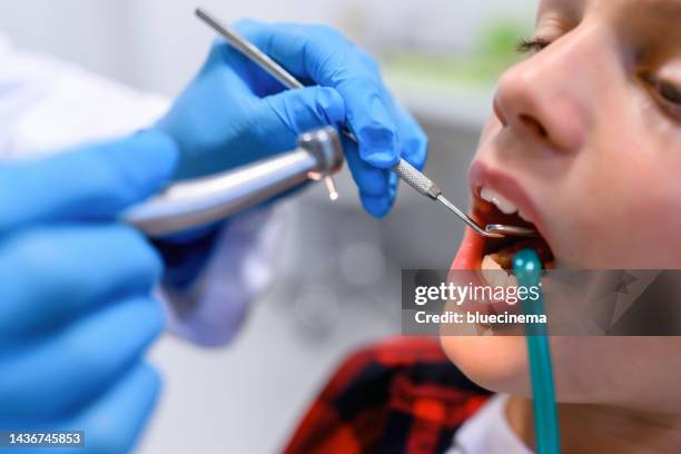 dentist examining a patient's teeth in dentist office. - dental caries stockfoto's en -beelden