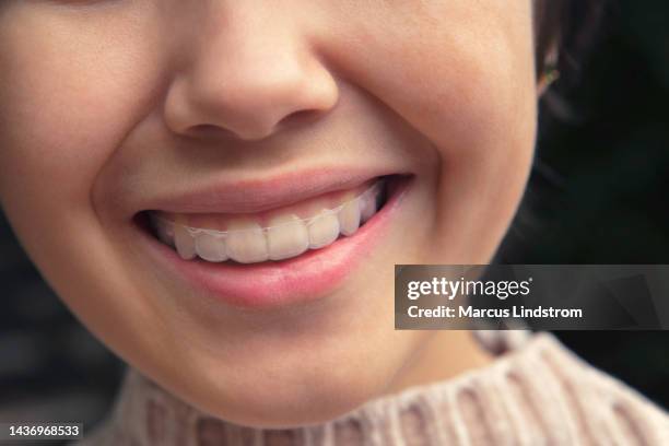 closeup of teenage girl smiling with dental aligner - invisalign stock pictures, royalty-free photos & images
