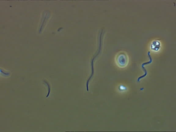Germs Moving 34 Spiral Shaped Bacteria Stock Videos, Footage, & 4K Video Clips ...
