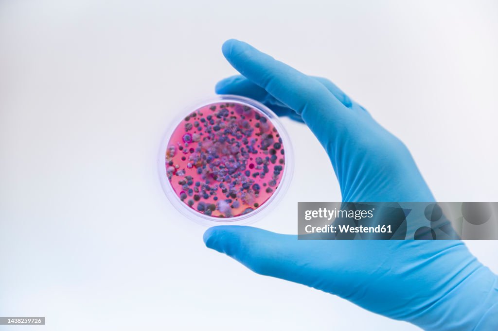 Scientist wearing protective glove holding fungal cultures in petri dish