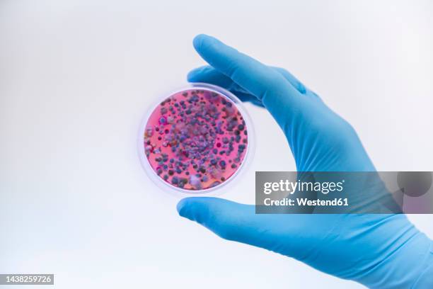 scientist wearing protective glove holding fungal cultures in petri dish - boîte de pétri photos et images de collection
