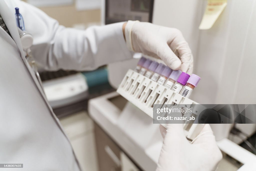 Picking Up A Medical Sample Test Tube From The Rack High-Res Stock ...