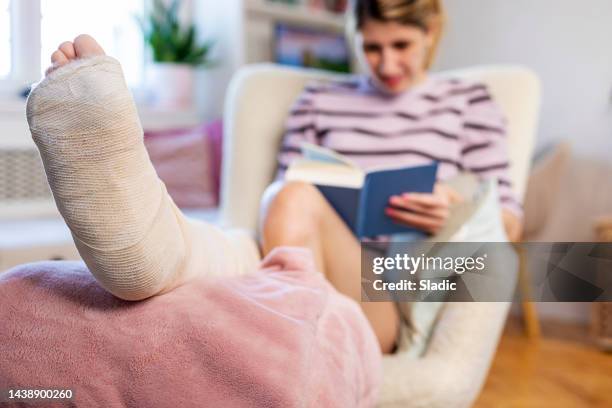 mujer joven con la pierna en un libro de lectura de yeso - pierna fracturada fotografías e imágenes de stock