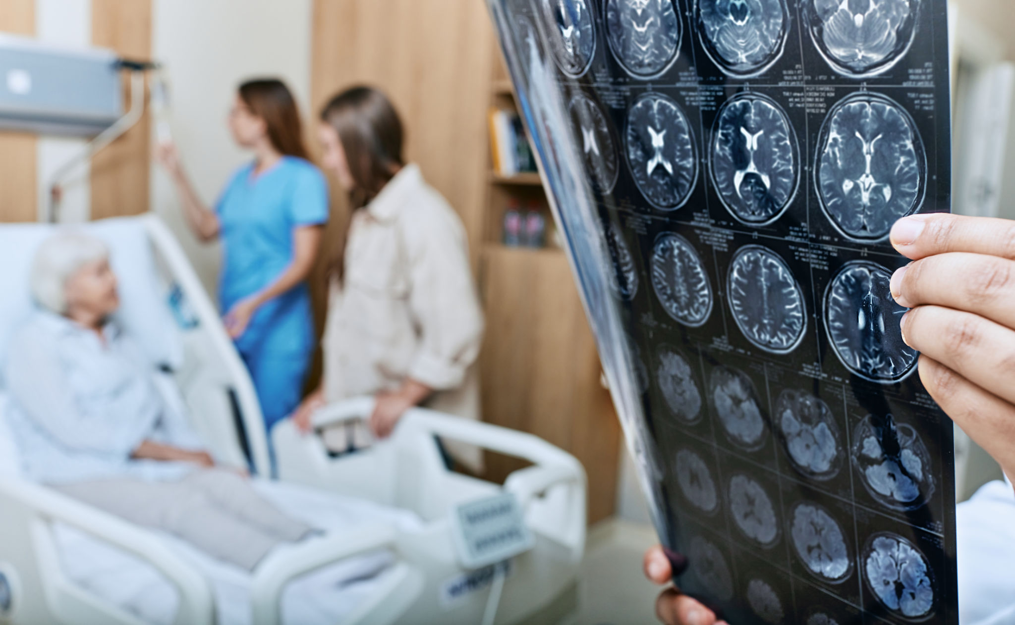 stroke rehabilitation