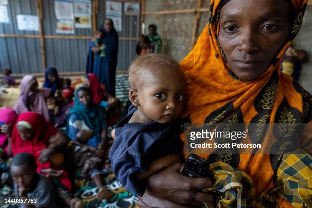 Malnourished Somali baby Adan Macalin Ali is held by his mother, Hawo Abdi Adan, after being measured at the Danwadaag Mother and Child Health...