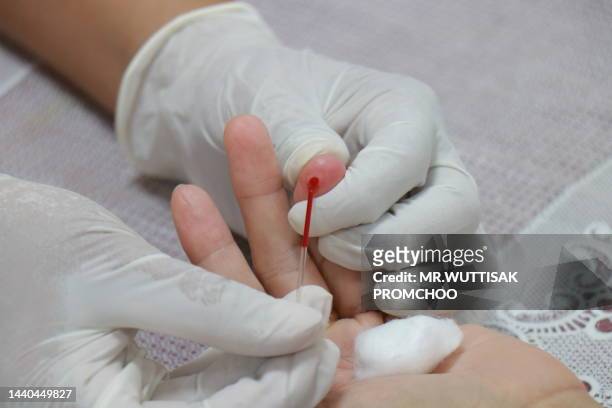 doctor with gloves piercing patients finger with lancet closeup. blood glucose monitoring concept. - diabetes symptoms stock pictures, royalty-free photos & images