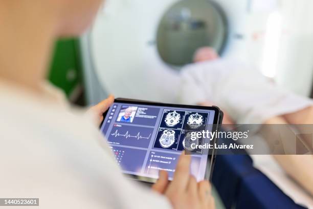 neurologist examining patient's cat scan images on digital table in clinic - cat scan stockfoto's en -beelden