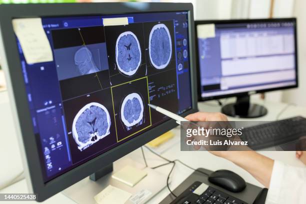 close-up of woman doctor looking at ct scan report on computer monitor - brain hand stock-fotos und bilder