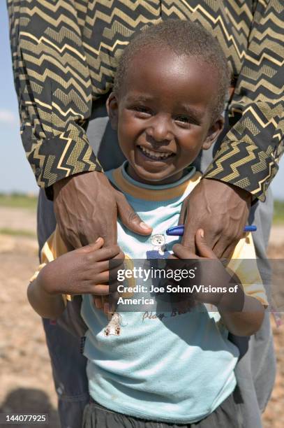 Young Kenya boy is infected with HIV/AIDS at Pepo La Tumaini Jangwani, HIV/AIDS Community Rehabilitation Program, Orphanage & Clinic, Pepo La Tumaini...