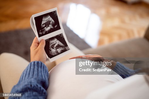 Pregnant woman sitting on the sofa at home, looking at the ultrasound scan photo of her baby. Pregnant woman sitting on the sofa at home, looking at the ultrasound scan photo of her baby.