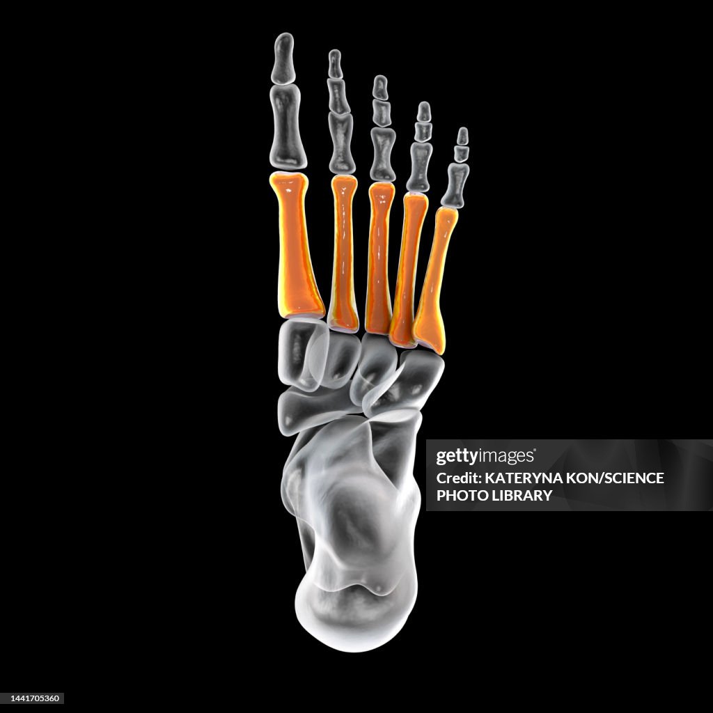 Metacarsus Metatarsal Bones Of The Foot Illustration High-Res Vector Graphic ...