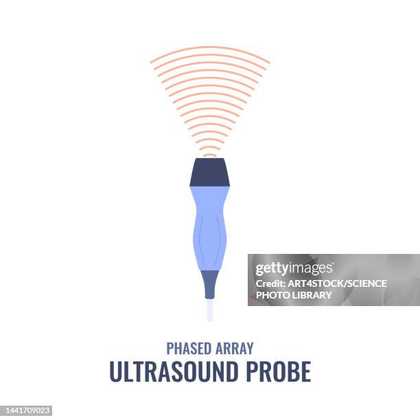 Probe Graphics Phased Array Ultrasound Probe Illustration High-Res Vector Graphic ...