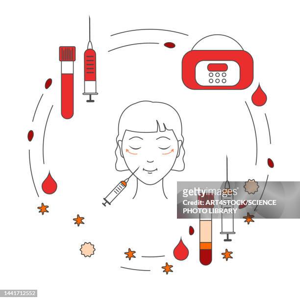 platelet-rich plasma rejuvenation, conceptual illustration - alternative therapy stock illustrations