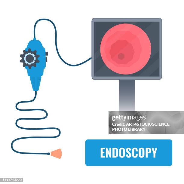 endoscopy equipment, illustration - biopsy stock illustrations