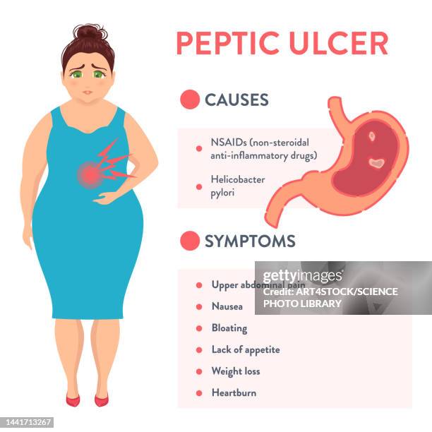 peptic ulcer symptoms, illustration - 内視鏡点のイラスト素材／クリップアート素材／マンガ素材／アイコン素材