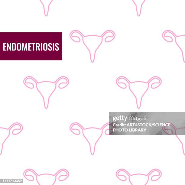 bildbanksillustrationer, clip art samt tecknat material och ikoner med endometriosis, conceptual illustration - äggledare