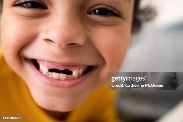 happy young mixed-race girl smiling & showing her two front missing teeth - kind zahnlücke stock-fotos und bilder