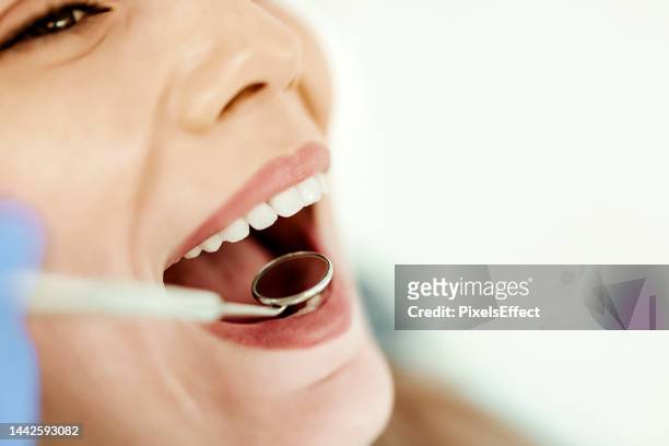 primo piano della bocca aperta durante il controllo orale - dentist office foto e immagini stock