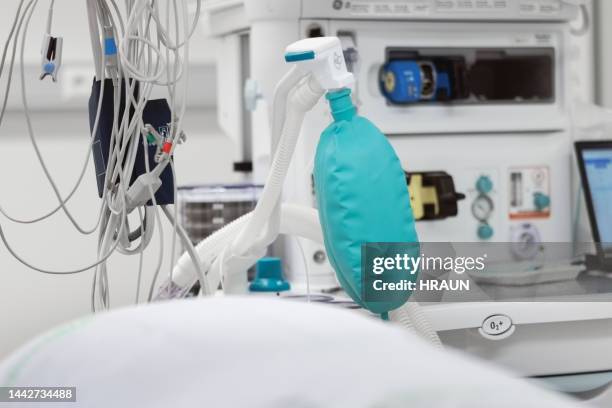 hospital ventilator machine in an operating room - ventilator stockfoto's en -beelden