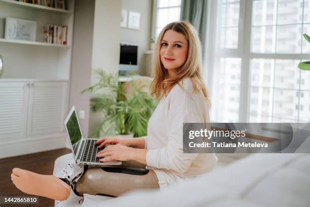 professional occupation at distant work. businesswoman with artificial legs using laptop, looking at camera with smile, working in living room - fake smile ストックフォトと画像
